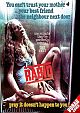 Rabid - Limited Fridge Edition (DVD+Blu-ray Disc)